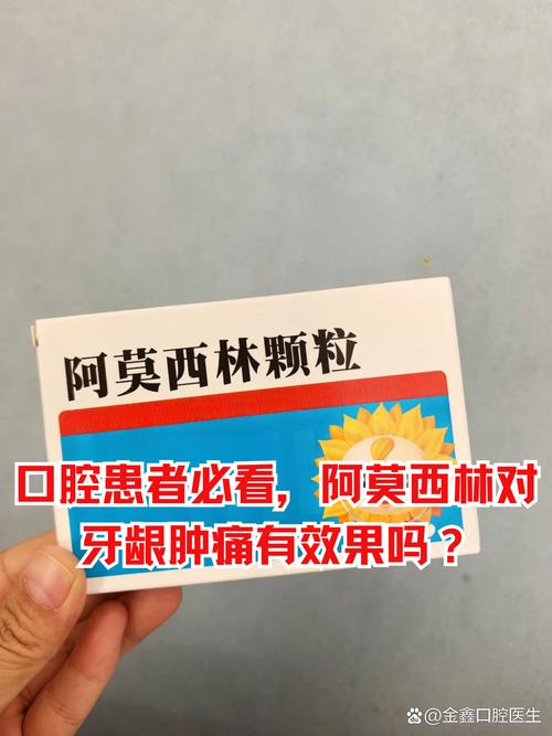 牙龈肿痛是口腔科门诊的常见症状,多由感染,创伤或牙周疾病引发